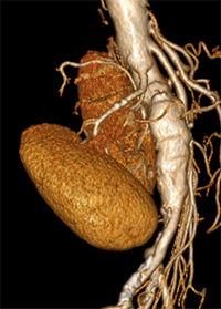 image scan of body organs