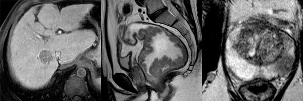 body MRI image