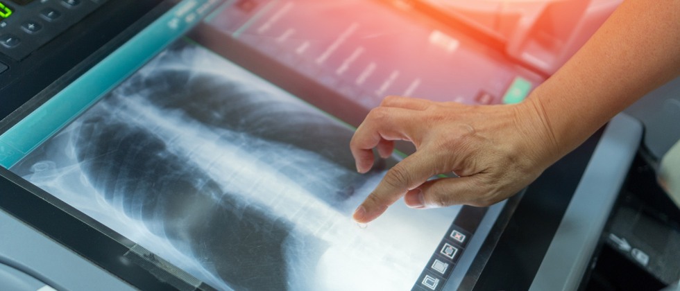Cardiothoracic Imaging | Radiology | Medical School | Brown University